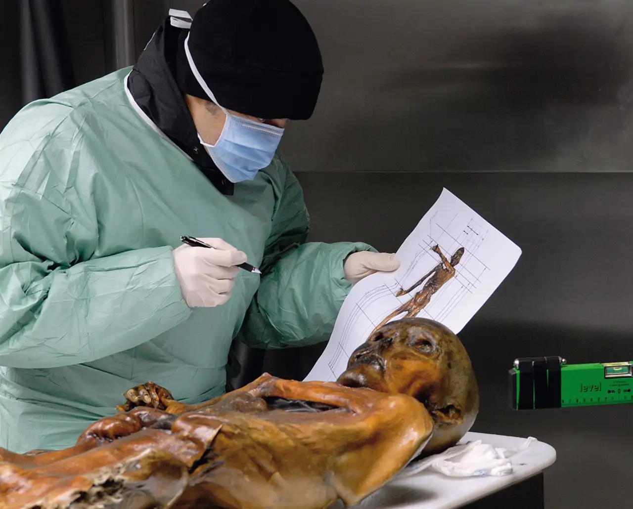 La momia de Ötzi portaba una cepa de VPH de alto riesgo propia de los humanos modernos