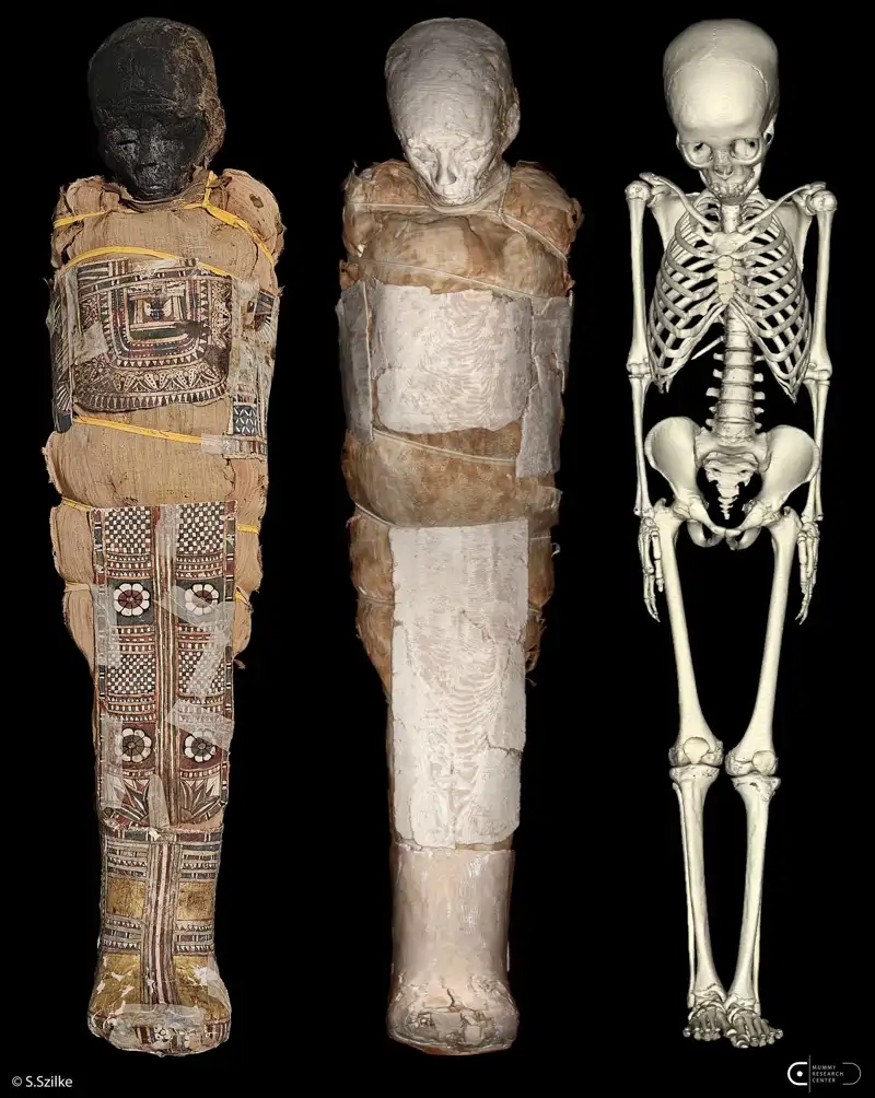 Child Mummy Photo Volume Rendering Skeleton Segmentation